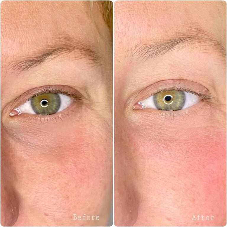 SEMI-PERMANENT CONCEALER