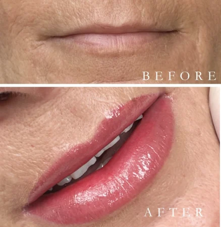 Pain Free Lip blush Training