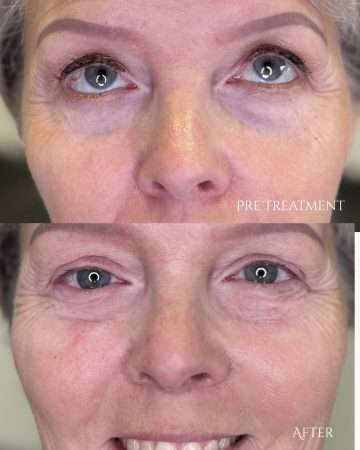 Green and Beige Minimalist Skincare Before After Collage Instagram Post - 1