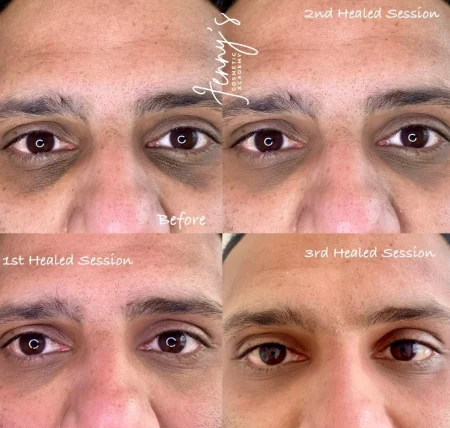 _ Healed- Healed Semi-permanent concealer webp