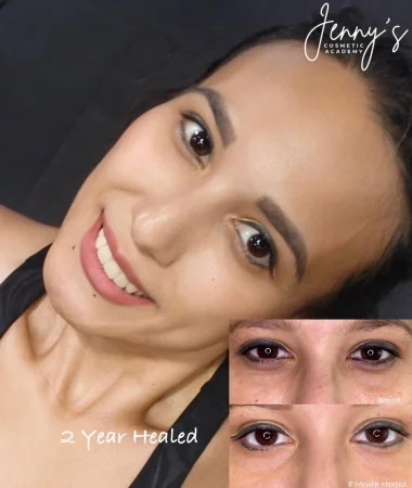 _ Healed- Semi-permanent concealer webp