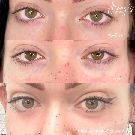 _ Healed- Semi-permanent concealer webp