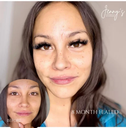_ Healed- Semi-permanent concealer webp[1]