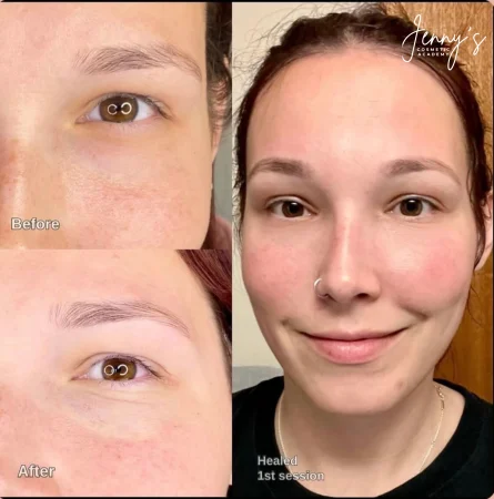 _ Healed- Semi-permanent concealer webp[1]