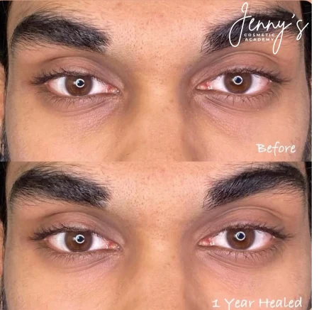 _ Healed- Semi-permanent concealer webp[1]