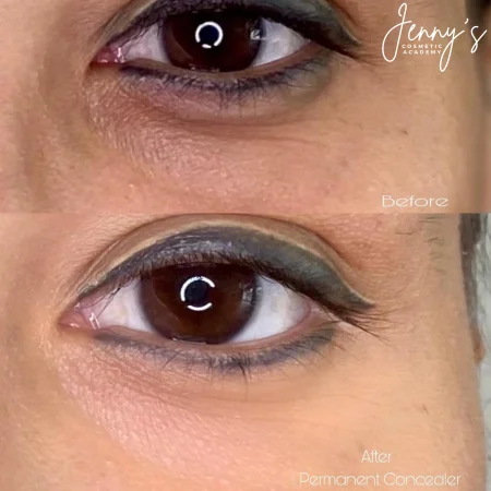 _ Healed- Semi-permanent concealer webp[2]