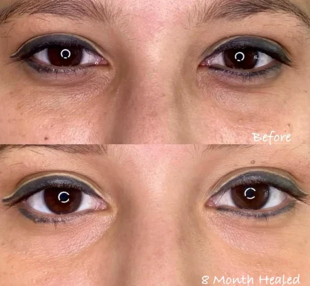 Semi-permanent concealer webp