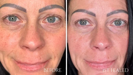 _ Semi-permanent concealer webp[1]
